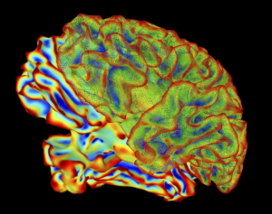 Công nghệ đột phá: Trí tuệ nhân tạo đọc được suy nghĩ con người