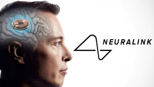 Công ty của Elon Musk cấy chip vào não người chỉ trong 1,5 giây, độ chính xác cực cao giúp tránh các mạch máu nhỏ