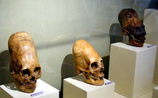 Giải mã sọ Paracas: Kết quả ADN sơ bộ hé lộ khác biệt gây chấn động với hộp sọ người hiện đại - Ảnh 2.
